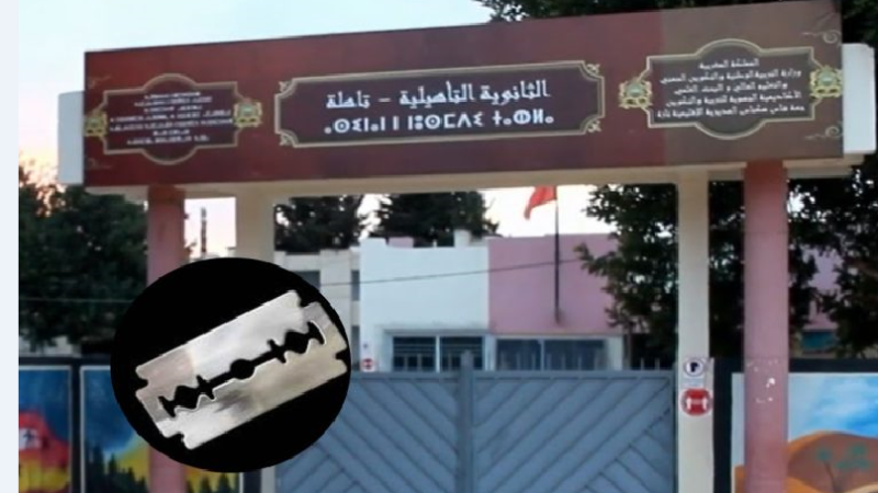 تلميذة ”شرملات” وجه صاحبتها بزيزوار وتم نقل الضحية في حالة حرجة إلى كلينيك بفاس