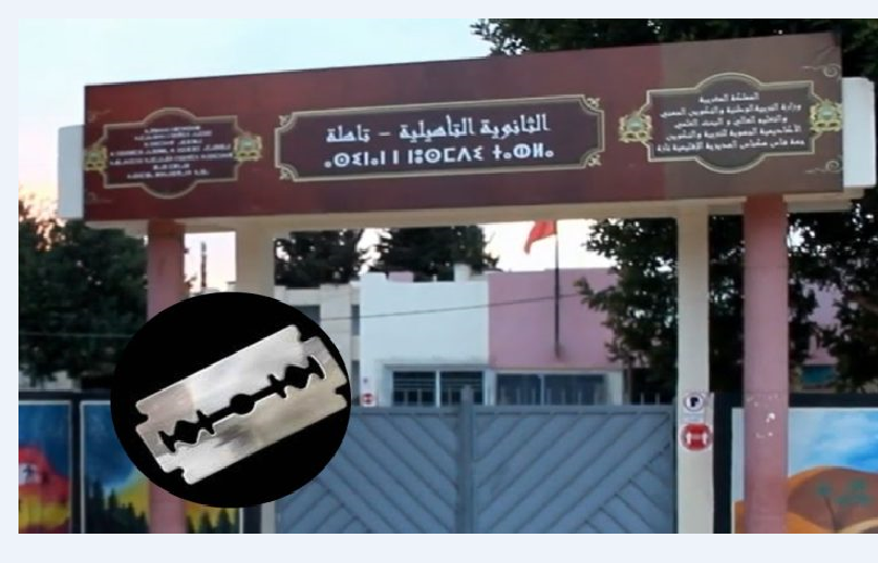 تلميذة ”شرملات” وجه صاحبتها بزيزوار وتم نقل الضحية في حالة حرجة إلى كلينيك بفاس